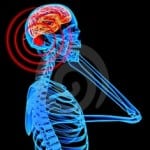mobile radiation